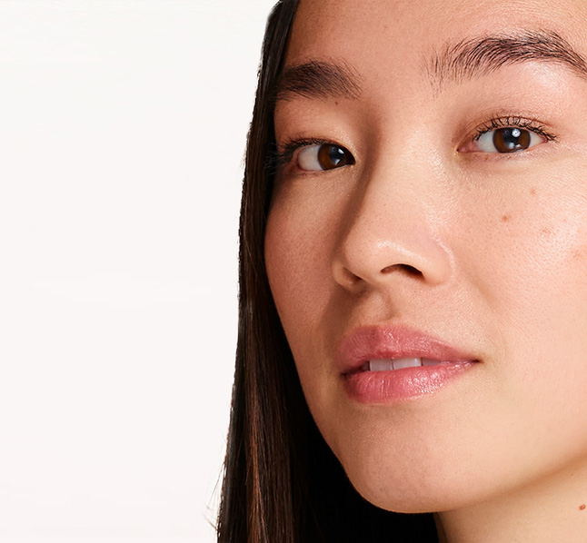 Kvinna med pigmentfläckar.