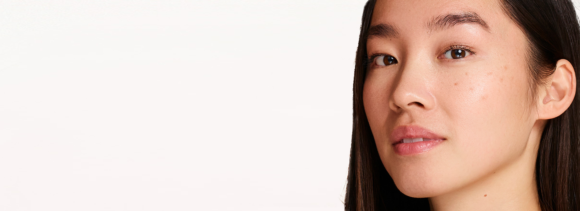 Kvinna med pigmentfläckar.