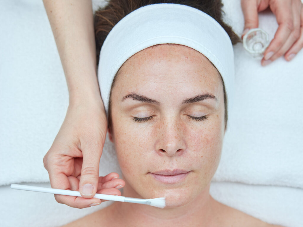 Bild av en kvinna som får en NEOSTRATA behandling med kemisk peeling.