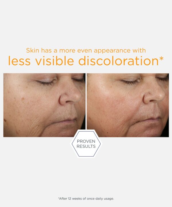 30251_neo_15_vitamin_c_serum_v5.jpg 30251_neo_15_vitamin_c_serum_v5.jpg