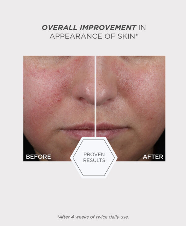 30324_Mandelic_Clarifying_Hydragel_v6.jpg 30324_Mandelic_Clarifying_Hydragel_v6.jpg