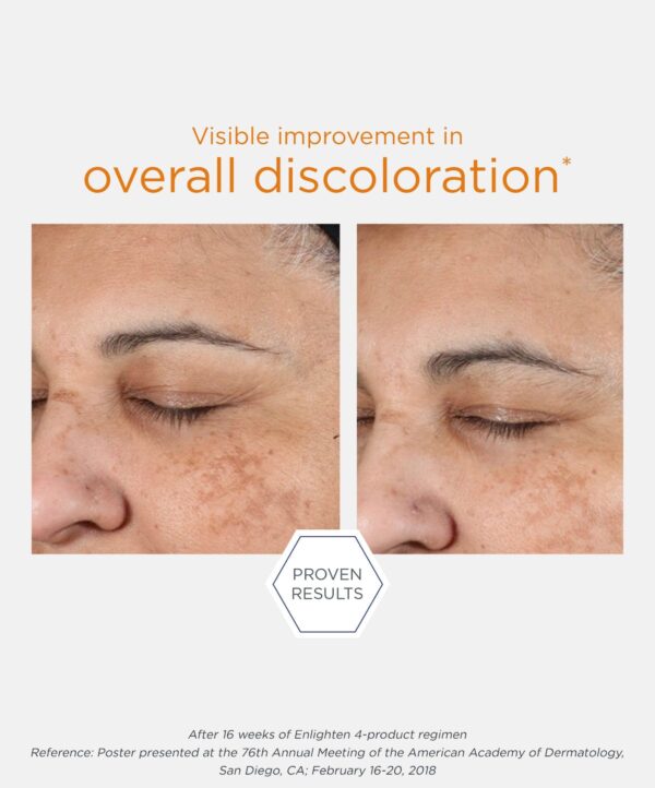 30160_neostrata_pigment_controller_v5.jpg 30160_neostrata_pigment_controller_v5.jpg