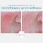 30139_neostrata_redness_neutralizing_serum_v5.jpg