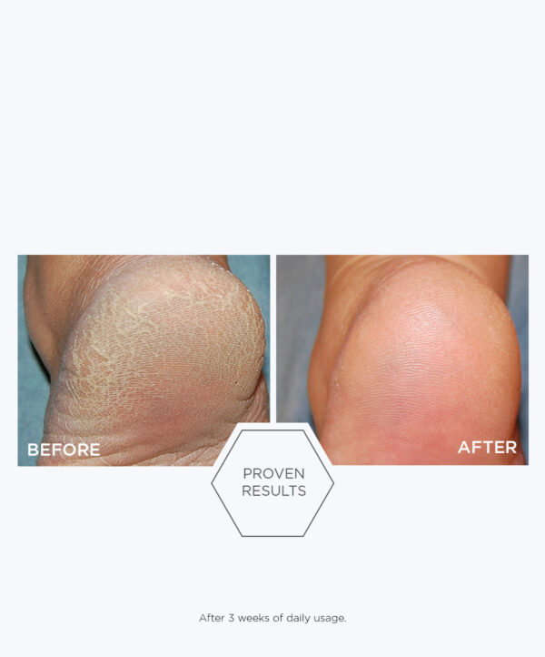 30154_neostrata_problem_dry_skin_cream_v6_.jpg 30154_neostrata_problem_dry_skin_cream_v6_.jpg