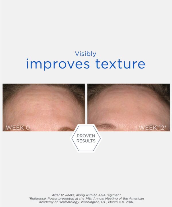 30134_neo_smooth_surface_glycolic_peel_v6.jpg 30134_neo_smooth_surface_glycolic_peel_v6.jpg