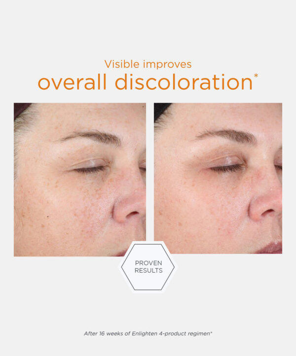 30161_neostrata_ENLIGHTEN_ILLUMINATING_SERUM_V5.jpg 30161_neostrata_ENLIGHTEN_ILLUMINATING_SERUM_V5.jpg